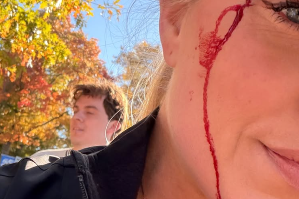 Áslaug Arna blóðgaðist í hlaupakeppni í New York