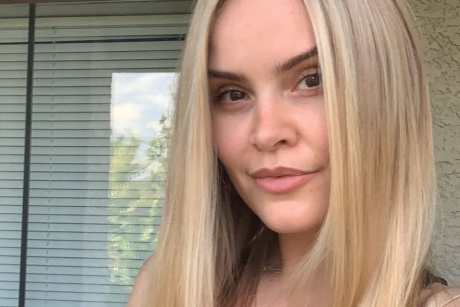 María Birta missti sjónina tímabundið eftir flókna aðgerð