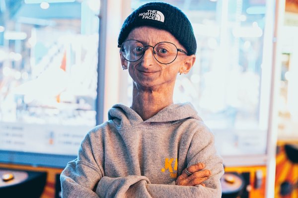 Michiel Vandeweert er látinn aðeins 28 ára gamall
