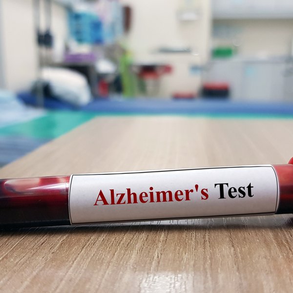 Ráðgáta Alzheimer mögulega leyst