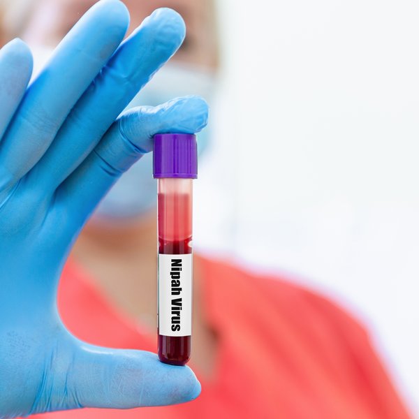 Fleiri smitast af hinni banvænu Nipah-veiru