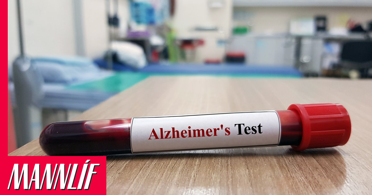 Ráðgáta Alzheimer mögulega leyst